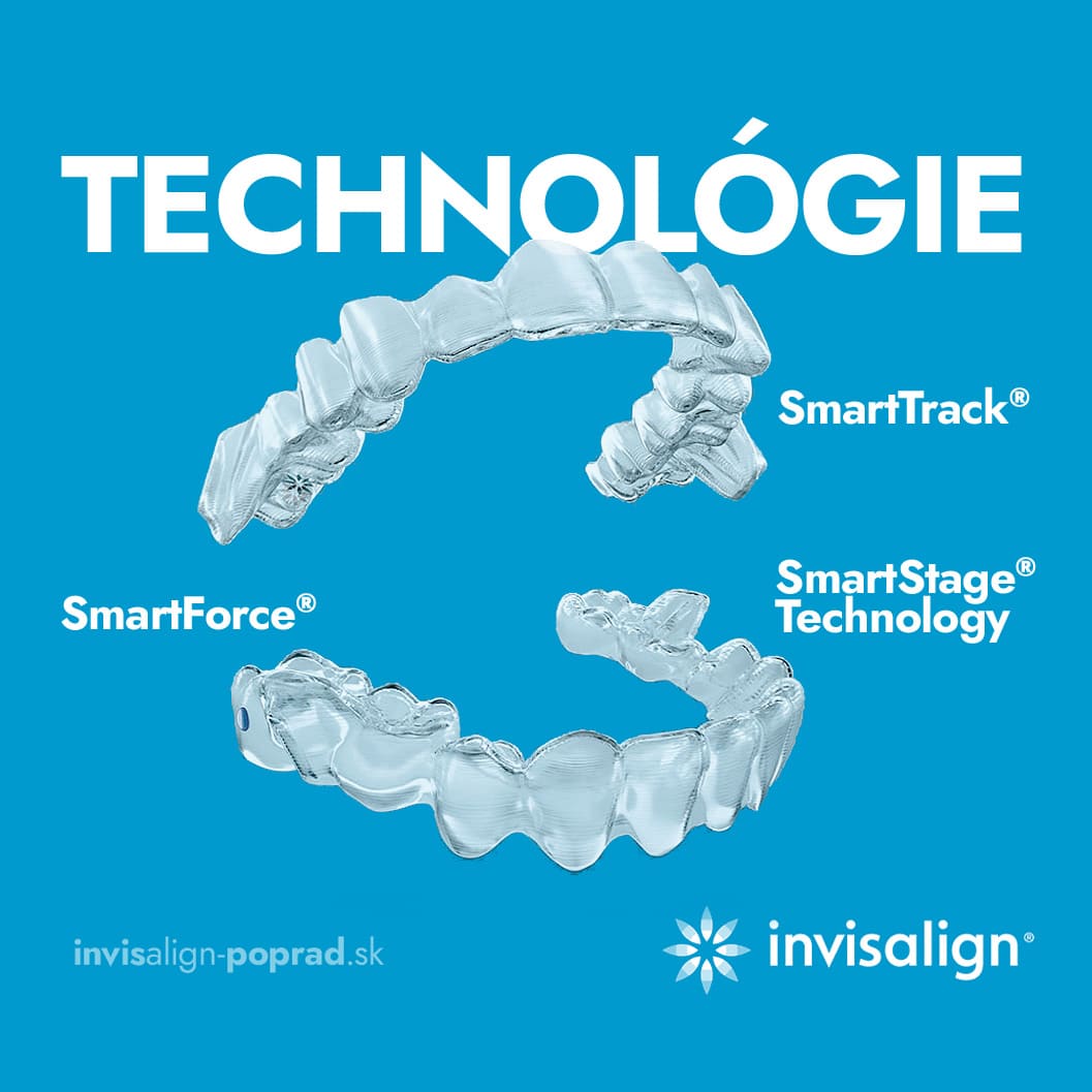 Technológie Invisalign