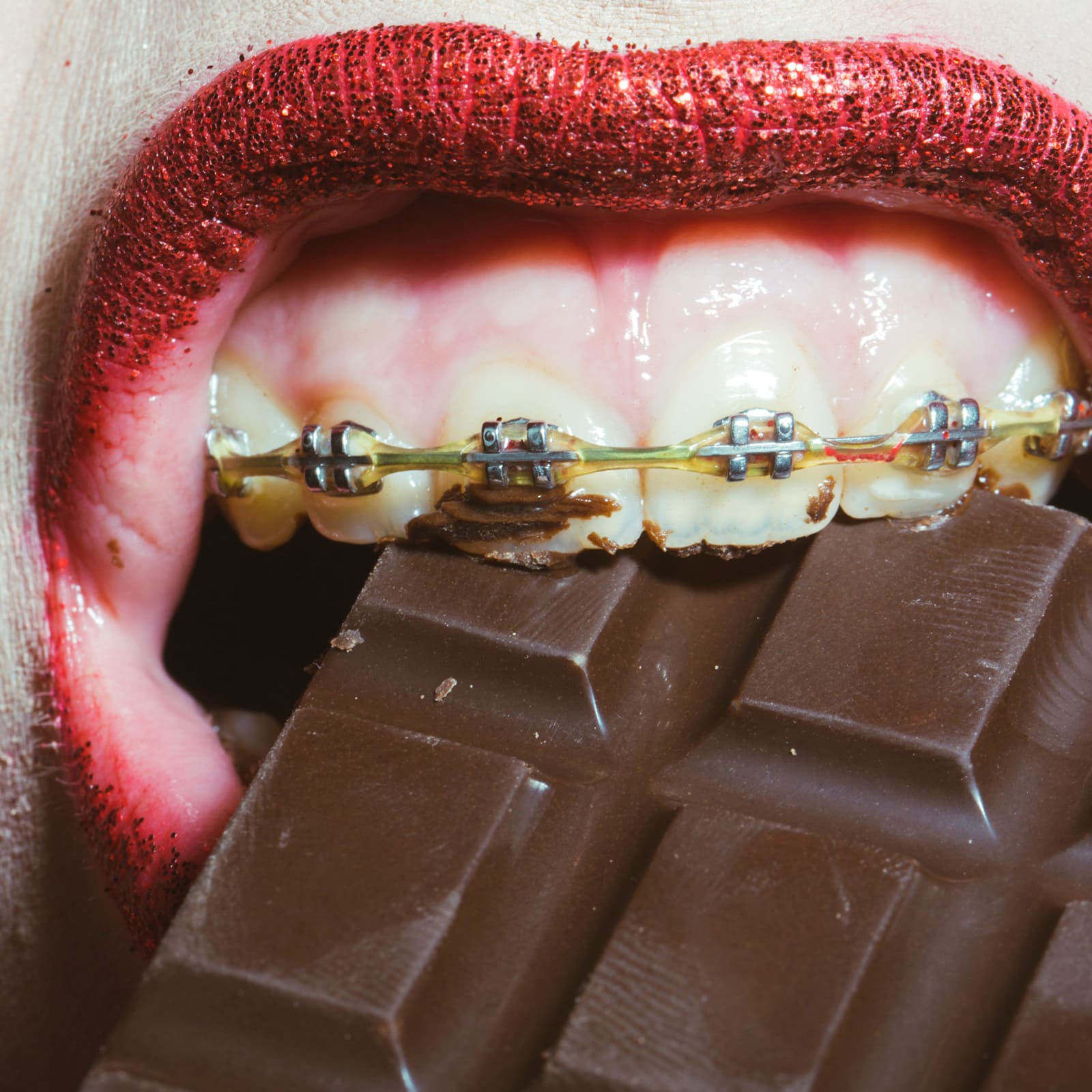 Neviditeľné zubné strojčeky Invisalign Vás neobmedzujú