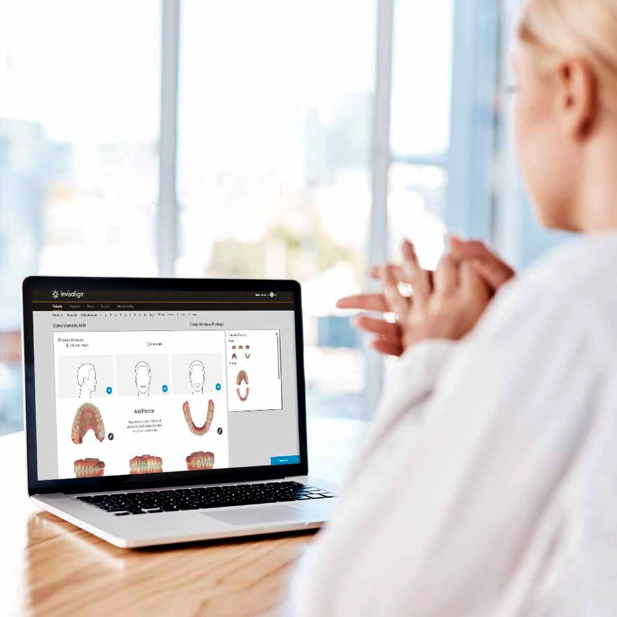 Neviditeľné zubné strojčeky Invisalign - iTero 